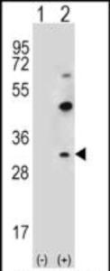 Anti-CLDN2 Rabbit Polyclonal Antibody