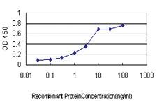 Anti-KCNIP3 Mouse Monoclonal Antibody [clone: 2B3-A1]