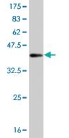 Anti-BRAF Mouse Monoclonal Antibody [clone: 1F2]