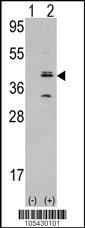 Anti-MVK Rabbit Polyclonal Antibody (AP (Alkaline Phosphatase))