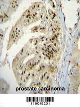 Anti-PAPOLA Rabbit Polyclonal Antibody (APC (Allophycocyanin))