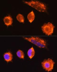 Immunofluorescence analysis of L929 cells using Anti-MGAT1 Antibody (A9848) at a dilution of 1:100 (40X lens). DAPI was used to stain the cell nuclei (blue)