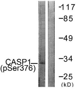 Western blot analysis of lysates from 293 cells using Anti-Caspase 1 (phospho Ser376) Antibody The right hand lane represents a negative control, where the antibody is blocked by the immunising peptide