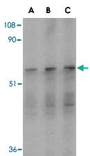 Anti-IRAK2 Rabbit Polyclonal Antibody