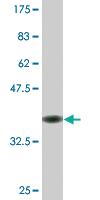 Anti-RNF138 Mouse Monoclonal Antibody [clone: 3G2]