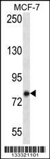 Anti-KCTD3 Rabbit Polyclonal Antibody (FITC (Fluorescein Isothiocyanate))