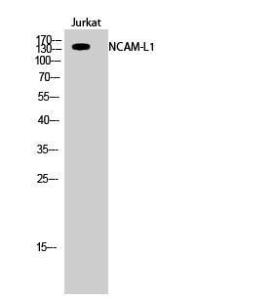 Western blot analysis of Jurkat cells using Anti-CD171 Antibody