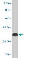 Anti-KLHL41 Mouse Monoclonal Antibody [clone: 1H3]