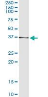 Anti-AKR7A2 Antibody Pair