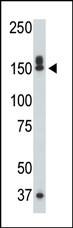 Anti-DAP Kinase 1 Rabbit Polyclonal Antibody (FITC (Fluorescein))