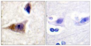 Immunohistochemical analysis of paraffin-embedded human brain using Anti-Caspase 1 (phospho Ser376) Antibody The right hand panel represents a negative control, where the antibody was pre-incubated with the immunising peptide