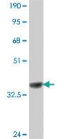 Anti-WARS Mouse Polyclonal Antibody