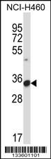 Anti-FCGR3A Rabbit Polyclonal Antibody (FITC (Fluorescein Isothiocyanate))