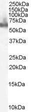 Anti-DOK3 Antibody (A83790) staining (0.1 µg/ml) of Human PBMC lysate (RIPA buffer, 35 µg total protein per lane). Primary incubated for 1 hour. Detected by western blot using chemilu minescence