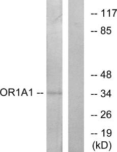 Western blot analysis of lysates from COLO cells using Anti-OR1A1 Antibody. The right hand lane represents a negative control, where the Antibody is blocked by the immunising peptide