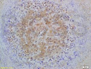 Anti-SMAD2 + SMAD3 Rabbit Polyclonal Antibody