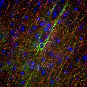 Immunofluorescence analysis of adult rat frontal cortex section stained with Anti-NF-M Antibody (1:5000/green) and Anti-NF-H Antibody (A85337/1:5000/red).