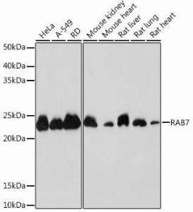 Western blot analysis of extracts of various cell lines, using Anti-RAB7 Antibody [ARC0314] (A306330) at 1:1,000 dilution. The secondary antibody was Goat Anti-Rabbit IgG H&L Antibody (HRP) at 1:10,000 dilution.