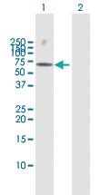 Anti-GRK6 Rabbit Polyclonal Antibody