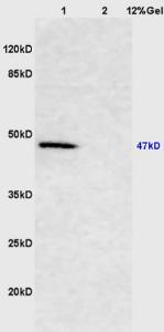 Anti-SMAD2 + SMAD3 Rabbit Polyclonal Antibody