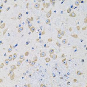 Immunohistochemistry analysis of paraffin-embedded mouse brain using Anti-MSRA Antibody (A9849) at a dilution of 1:100 (40X lens). Perform microwave antigen retrieval with 10 mM PBS buffer pH 7.2 before commencing with IHC staining protocol