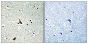 Immunohistochemical analysis of paraffin-embedded human brain using Anti-Caspase 1 (phospho Ser376) Antibody 1:100 (4°C overnight) The right hand panel represents a negative control, where the antibody was pre-incubated with the immunising peptide