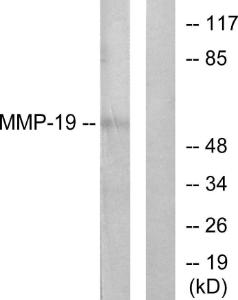 Antibody anti-MMP-19 100 µg