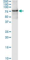 Anti-GRK6 Rabbit Polyclonal Antibody