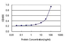 Anti-HIP1 Antibody Pair