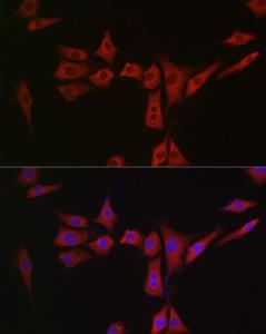 Immunofluorescence analysis of NIH/3T3 cells using Anti-MSRA Antibody (A9849) at a dilution of 1:300 (40X lens). DAPI was used to stain the cell nuclei (blue)