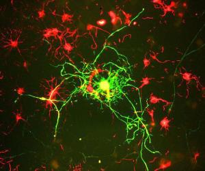 Culture of adult neural cells. Mature neurons can be identified by their morphology and because they stain strongly with Antibodyies to NF-L, NF-M and NF-H. The surrounding stellate red cells are stained with Anti-Alpha-Internexin Antibody (A85441).