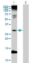 Anti-C1QTNF1 Rabbit Polyclonal Antibody