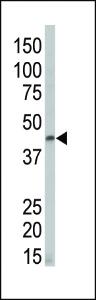 Anti-DAPK2 Rabbit Polyclonal Antibody (APC (Allophycocyanin))