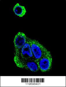 Anti-ADH1B Rabbit Polyclonal Antibody