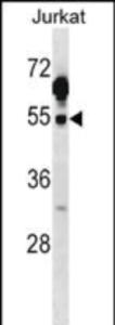 Anti-CSK Rabbit Polyclonal Antibody