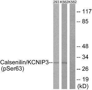 Anti-CSEN Rabbit Polyclonal Antibody