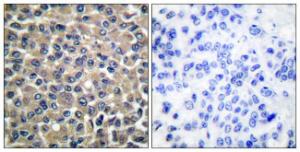 Antibody anti-MMP-19 100 µg