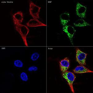 Confocal imaging of NIH/3T3 cells using Anti-RAB7 Antibody [ARC0314] (A306330), at a dilution of 1:100, (green). The cells were counterstained with Anti-alpha Tubulin Antibody, at a dilution of 1:100, (red). DAPI was used for nuclear staining (Blue). Objective: 60x.