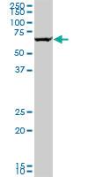 Anti-GRK6 Mouse Monoclonal Antibody [clone: 2C3]