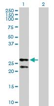 Anti-PRDX3 Rabbit Polyclonal Antibody