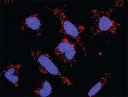 Anti-MAP3K14 + TRAF6 Antibody Pair