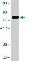 Anti-CKM Mouse Monoclonal Antibody [clone: 3E1-F3]