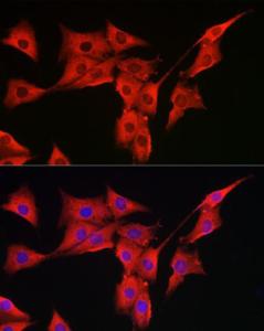 Immunofluorescence analysis of PC-12 cells using Anti-MSRA Antibody (A9849) at a dilution of 1:300 (40X lens). DAPI was used to stain the cell nuclei (blue)