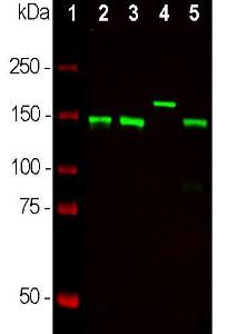 Western blot analysis of neuronal tissue lysates using Anti-NF-M Antibody (1:10000/green): [1] protein standard (red), [2] rat spinal cord, [3] mouse spinal cord, [4] cow spinal cord, [5] rat sciatic nerve