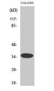 Western blot analysis of various cells using Anti-OR1A1 Antibody