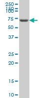 Anti-GRK6 Mouse Monoclonal Antibody [clone: 2C3]