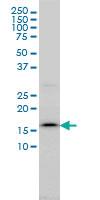 Anti-SSR4 Mouse Monoclonal Antibody [clone: 2D3]