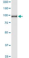 Anti-AGGF1 Polyclonal Antibody Pair