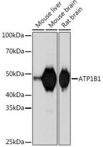 Western blot analysis of extracts of various cell lines, using Anti-ATP1B1 Antibody [ARC1232] (A309240) at 1:1,000 dilution. The secondary antibody was Goat Anti-Rabbit IgG H&L Antibody (HRP) at 1:10,000 dilution.