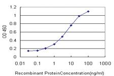 Anti-GRK6 Mouse Monoclonal Antibody [clone: 2C3]